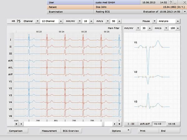 Management software / medical / electrocardiography Custo med